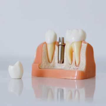 dentist north tampa, bay smiles dentistry, dr monica perez